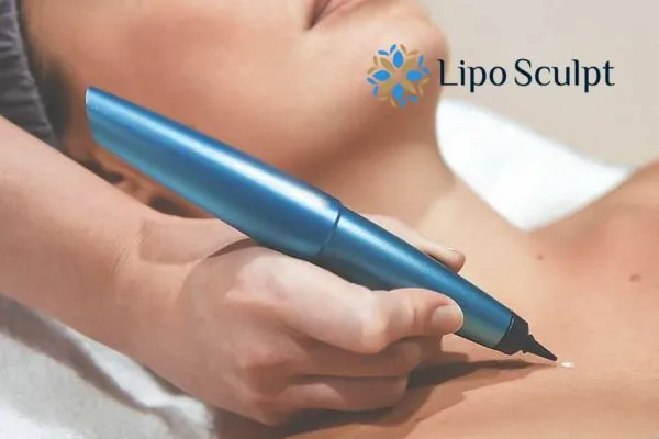 Dermatofibromas: What to Know About Treatment Options 2 What happens during CryoPen treatment?