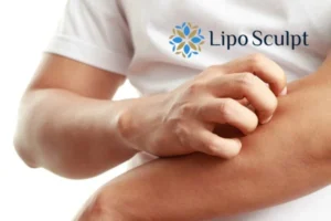 Best Actinic Keratoses Removal 4 prevent your actinic keratoses Llanelli getting worse - call our team today!