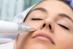 Best Actinic Keratoses Removal 3 Actinic keratoses Llanelli solutions - book in today!